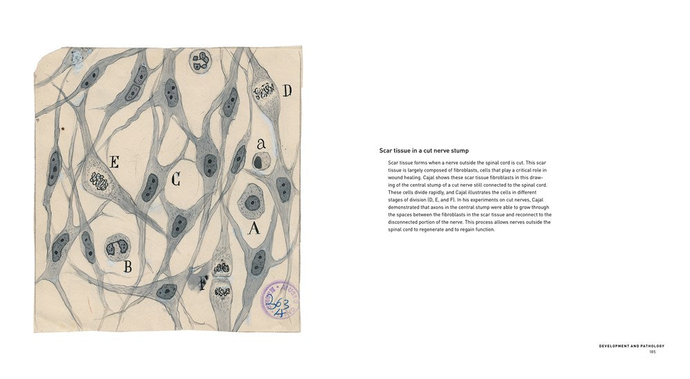 The Beautiful Brain